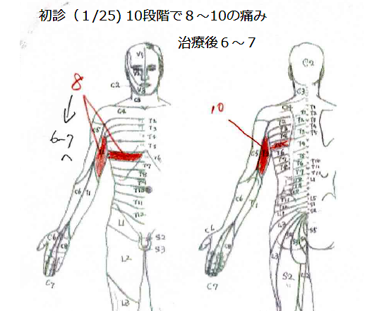 【初診】1月25日