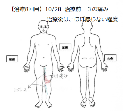 【治療8回目】10月23日